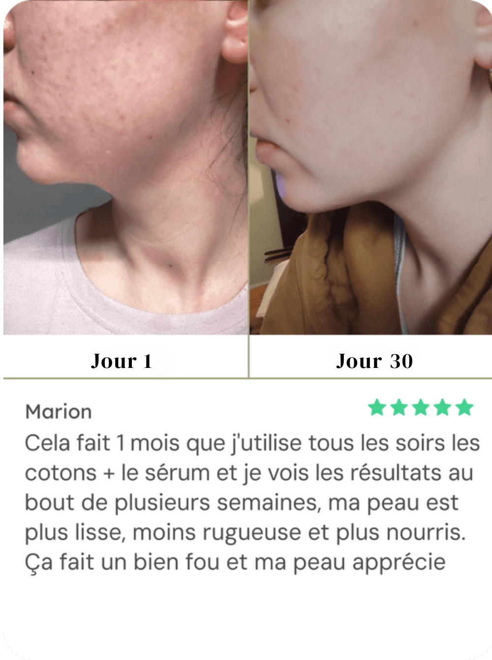 Coton Glow Up - Curcuma & Acide Kojique